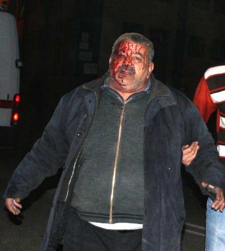 Diyarbakır'da patlama - Resim 26