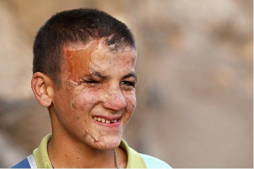 TFMD Yılın Basın Fotoğrafları 2007  - Resim 20