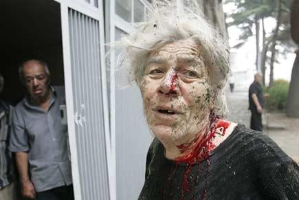 Savaşın vahşi yüzünden kareler