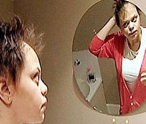 Jade Goody kanserle mücadelede - Resim 2