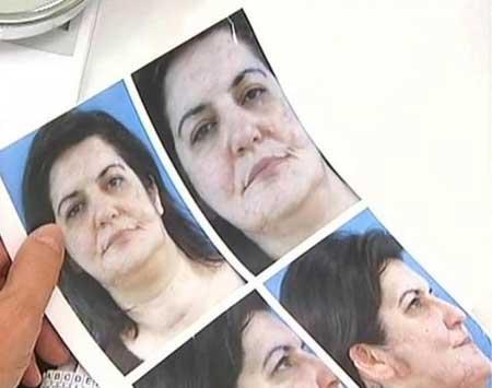 Koca vahşeti - Resim 3