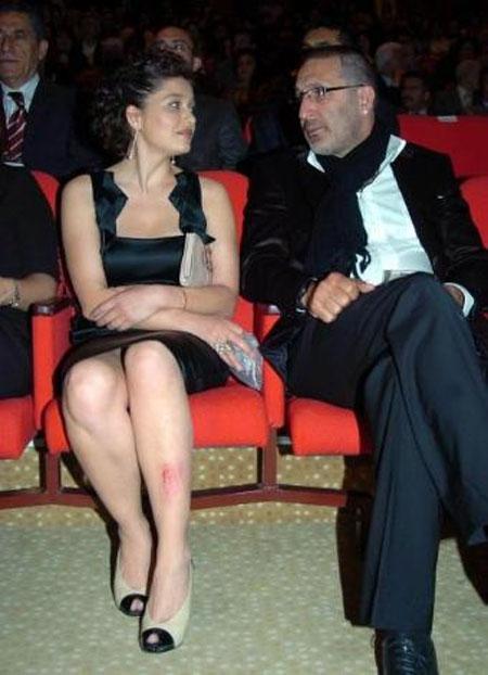 Nurgül Yeşilçay merdivenlerden düştü - Resim 11