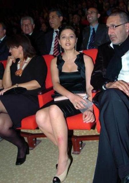 Nurgül Yeşilçay merdivenlerden düştü - Resim 8
