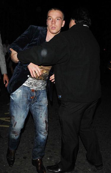 Seksi mankenin yüzünü parçaladılar