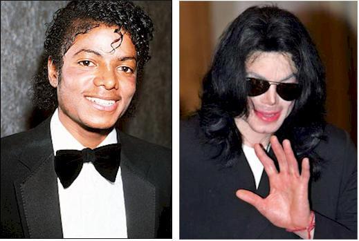 Michael Jackson öldü - Resim 6