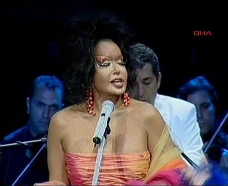 Bülent Ersoy'un ceninli yüzü 