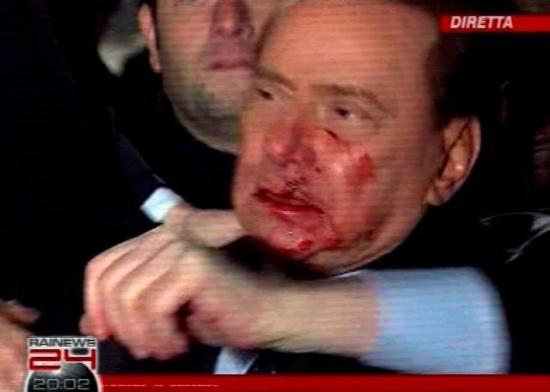 Berlisconi'nin burnunu kırdılar - Resim 6