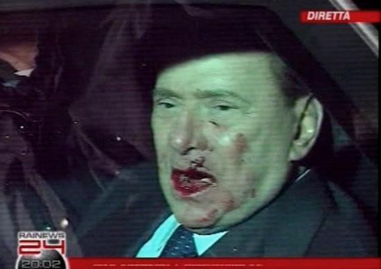 Berlisconi'nin burnunu kırdılar - Resim 1