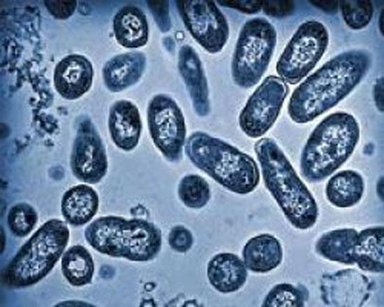 Milyonlarca kişinin ölümüne yol açan hastalıklar