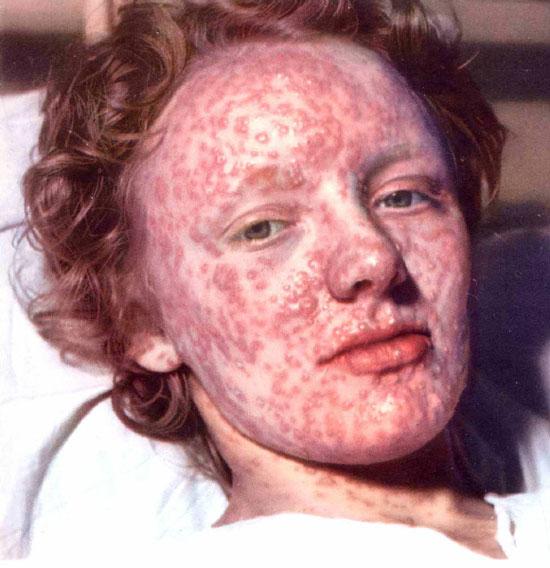 Milyonlarca kişinin ölümüne yol açan hastalıklar