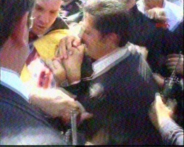 Bakan Yıldız'a yumruklu saldırı - Resim 17