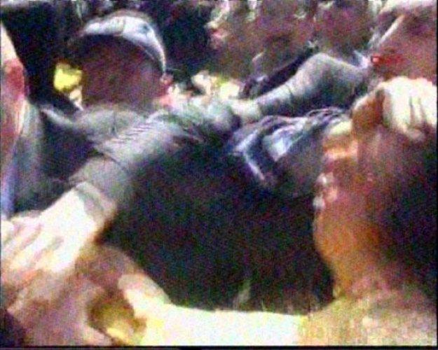 Bakan Yıldız'a yumruklu saldırı - Resim 9