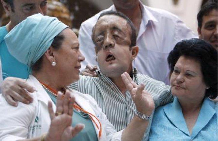 Yüz naklinden sonra ilk kez göründü - Resim 10