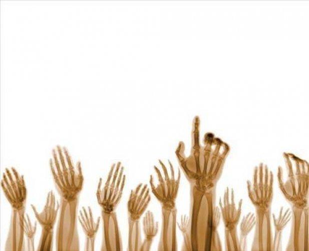 Dünyayı X ışınlarıyla görmeye hazır mısınız - Resim 4