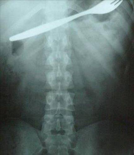 En ilginç tıbbi vakalar