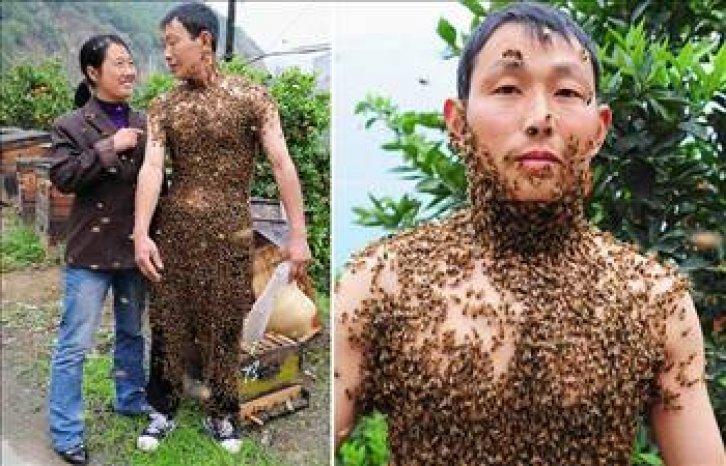 En ilginç tıbbi vakalar