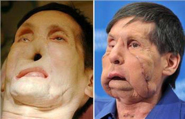 En ilginç tıbbi vakalar