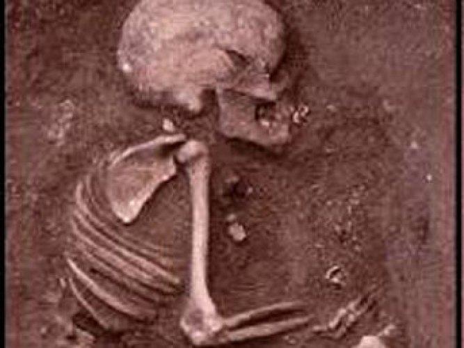 En ilginç ölümler