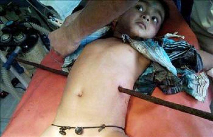 En ilginç tıbbi vakalar