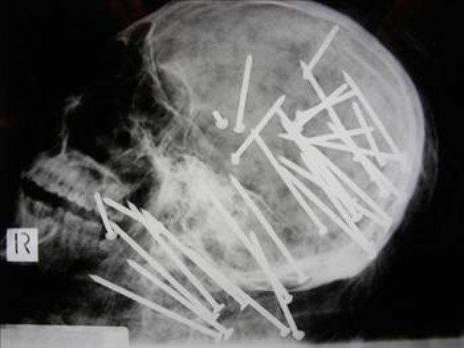 En ilginç tıbbi vakalar