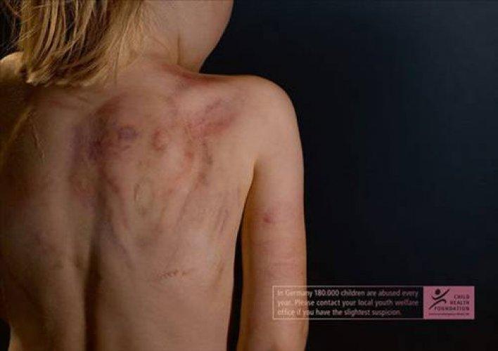 Ürkütücü reklamlar - Resim 48