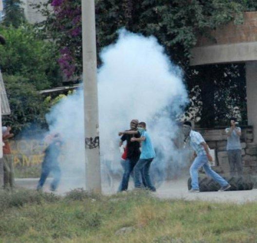 Molotof elinde patladı