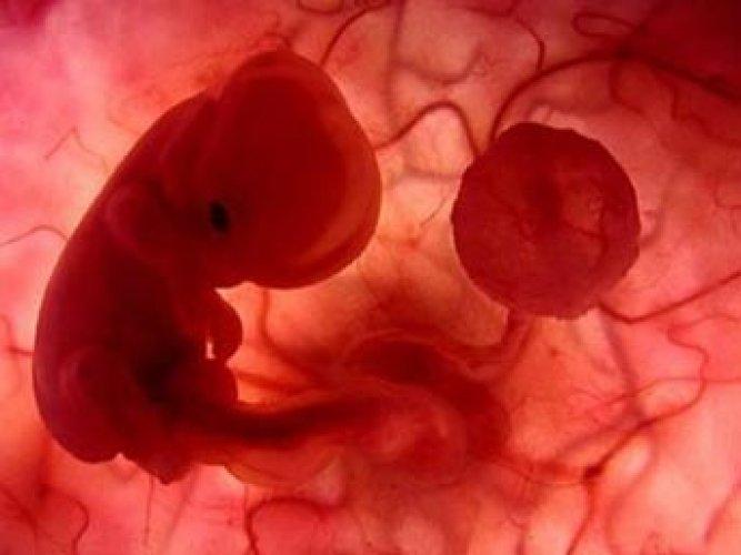 Ölümle ilgili hiç bilmedikleriniz