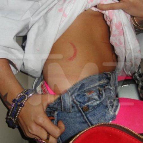 Şarkıcı Tila Tequila sahnede saldırı  - Resim 5