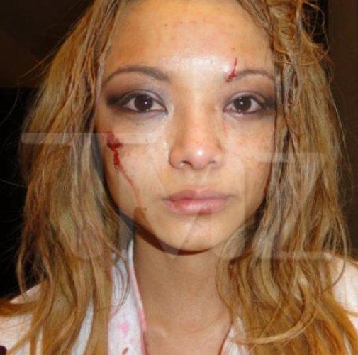 Şarkıcı Tila Tequila sahnede saldırı  - Resim 4