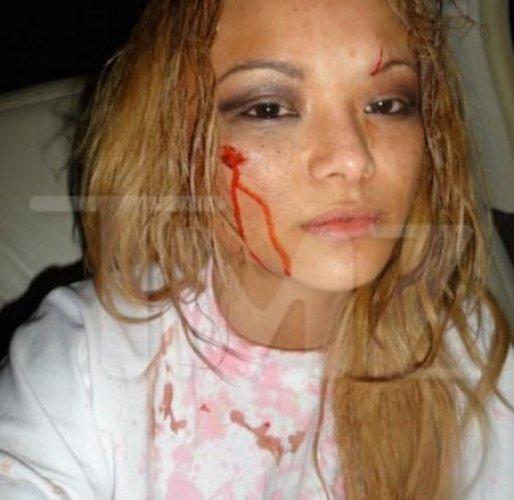 Şarkıcı Tila Tequila sahnede saldırı  - Resim 1
