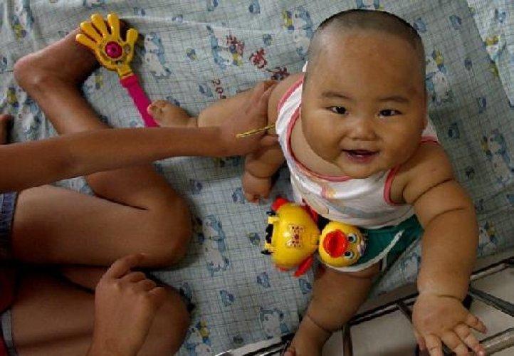 Dünyanın en şişman bebeği 