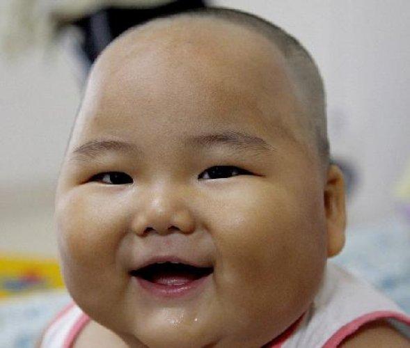 Dünyanın en şişman bebeği 