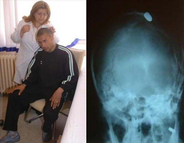 Yurdum insanı güldürüyor - 2 - Resim 23