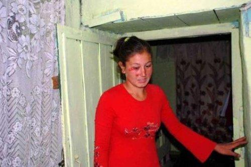 Gerçekten kan ağlıyor - Resim 3
