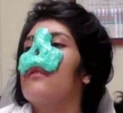Burnu kesilen Afgan kız artık gülüyor - Resim 3