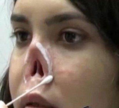Burnu kesilen Afgan kız artık gülüyor - Resim 2