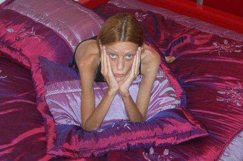 Isabelle Caro anoreksiyadan öldü