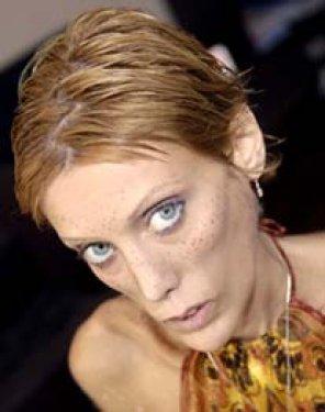 Isabelle Caro anoreksiyadan öldü