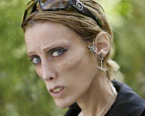 Isabelle Caro anoreksiyadan öldü