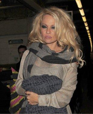 Pamela Anderson saldırıya uğradı - Resim 4