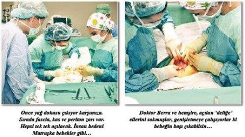 Ayşe Arman sezaryan doğuma girdi - Resim 3