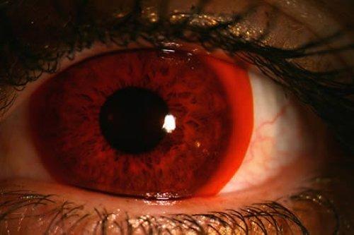 Bu lenslerden gözünüz korkmasın