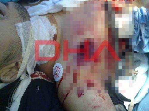 Libya'dan vahşet kareleri