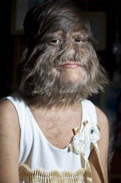 Kurt Kız Sepatra Guiness Rekorlar Kitabı'nda