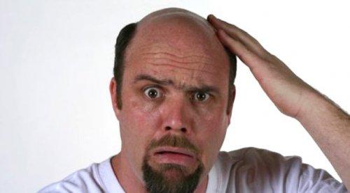 Kellik hakkında 6 efsane  