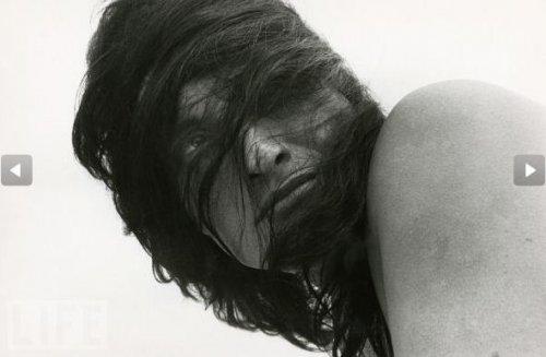 Yürek burkan bir AIDS hikayesi