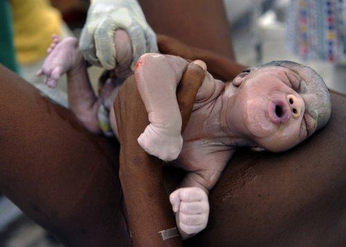 2011 Pulitzer ödülü alan fotoğraflar