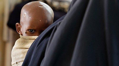 Somali dünyanın en feci felaketini yaşıyor