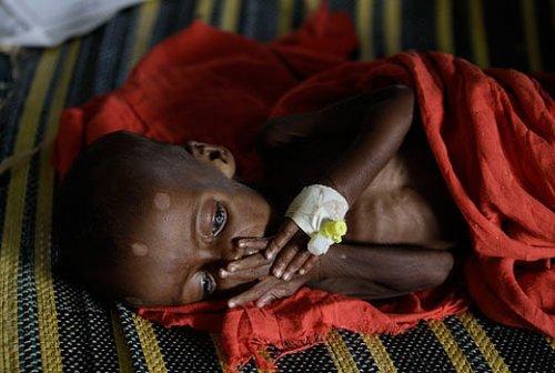 Somali dünyanın en feci felaketini yaşıyor