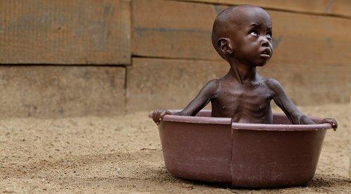 Somali dünyanın en feci felaketini yaşıyor